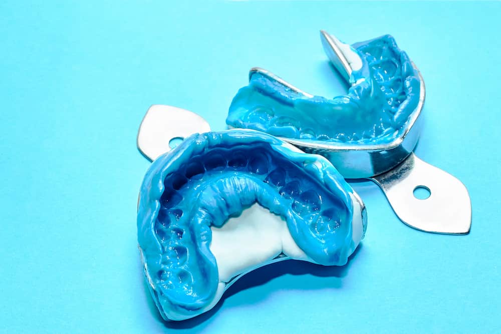آلژینات دندانپزشکی چیست